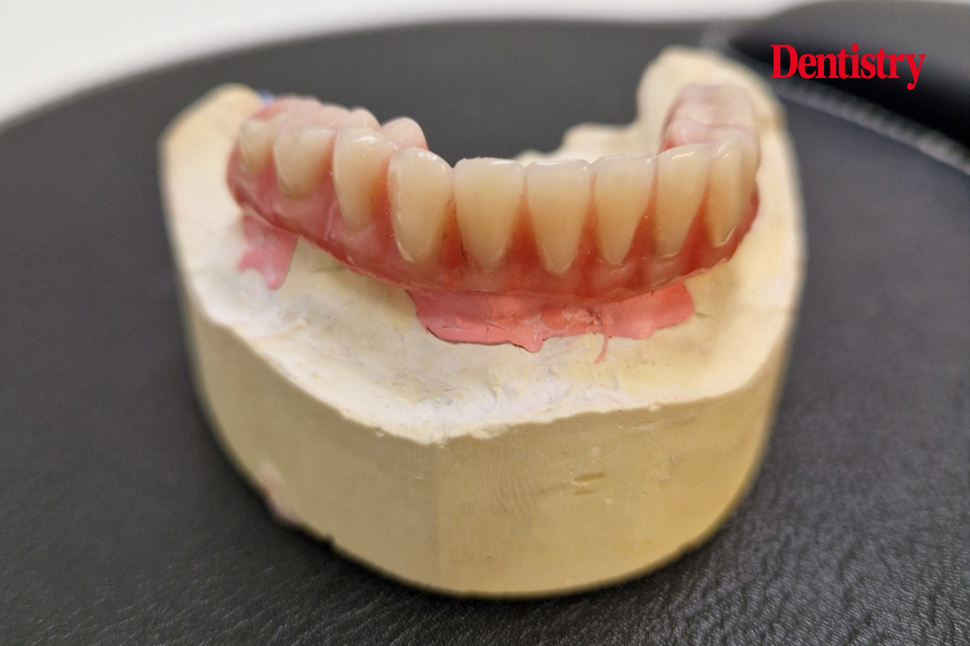 The 'all-on-four' concept restoration on lower jaw