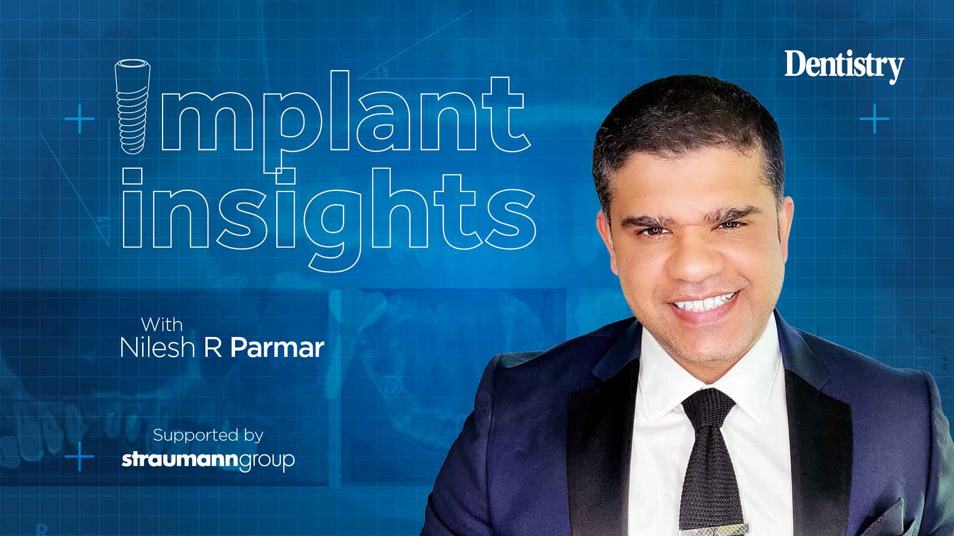 implant insights immediate implant