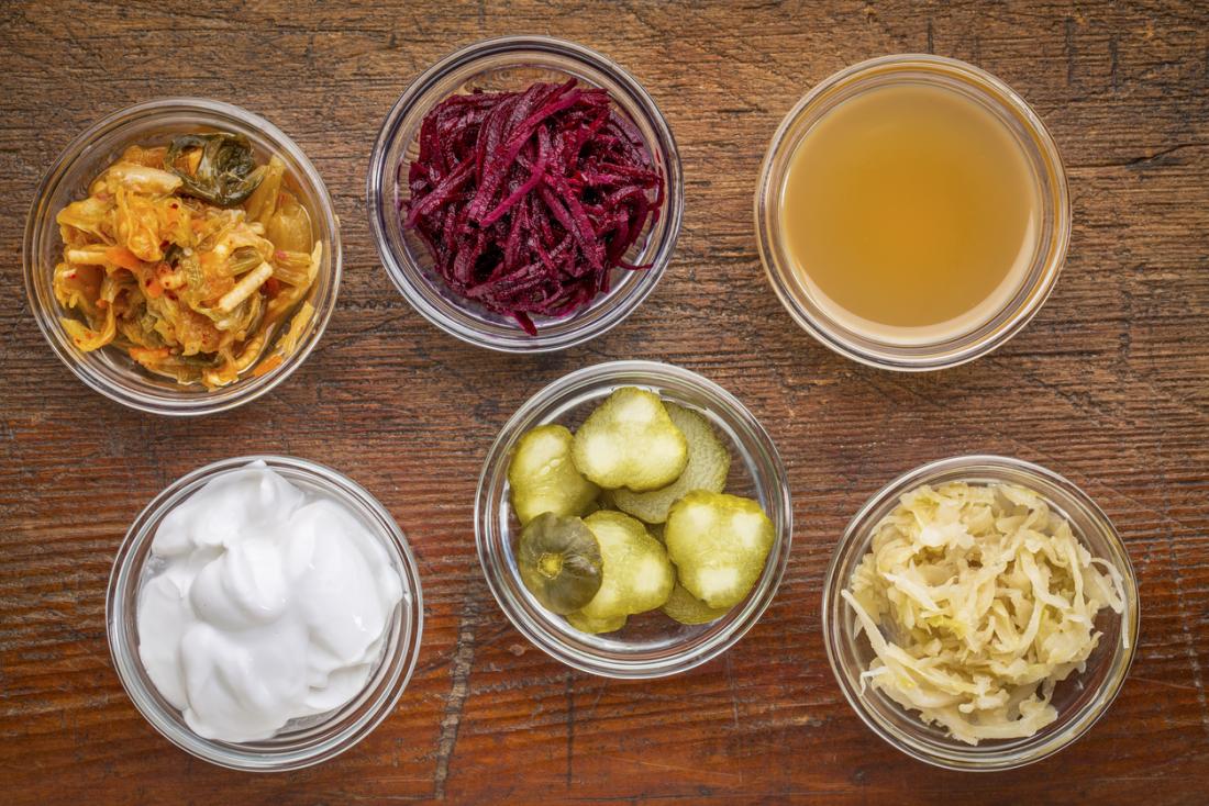a range of fermented foods that contain probiotics, including pickles, kimchi, kombucha, and yoghurt.