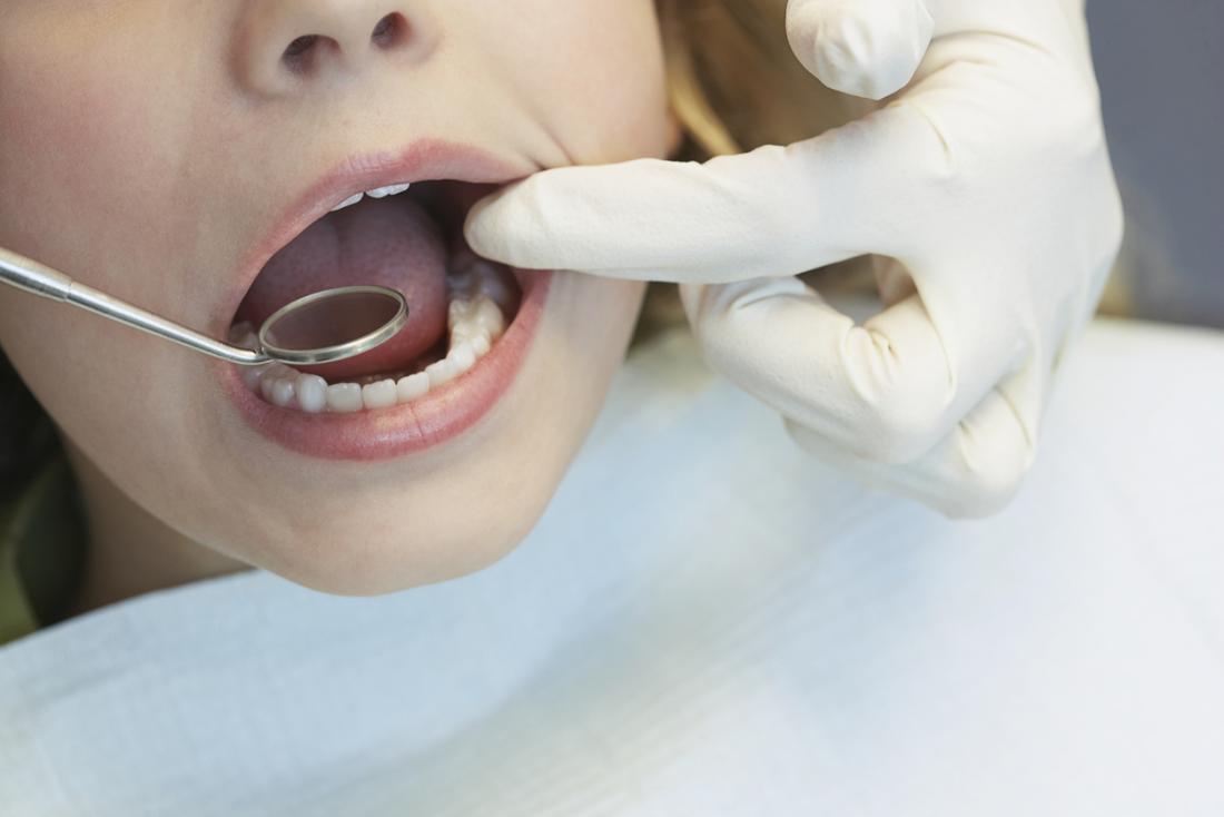 dentist inspecting patients mouth