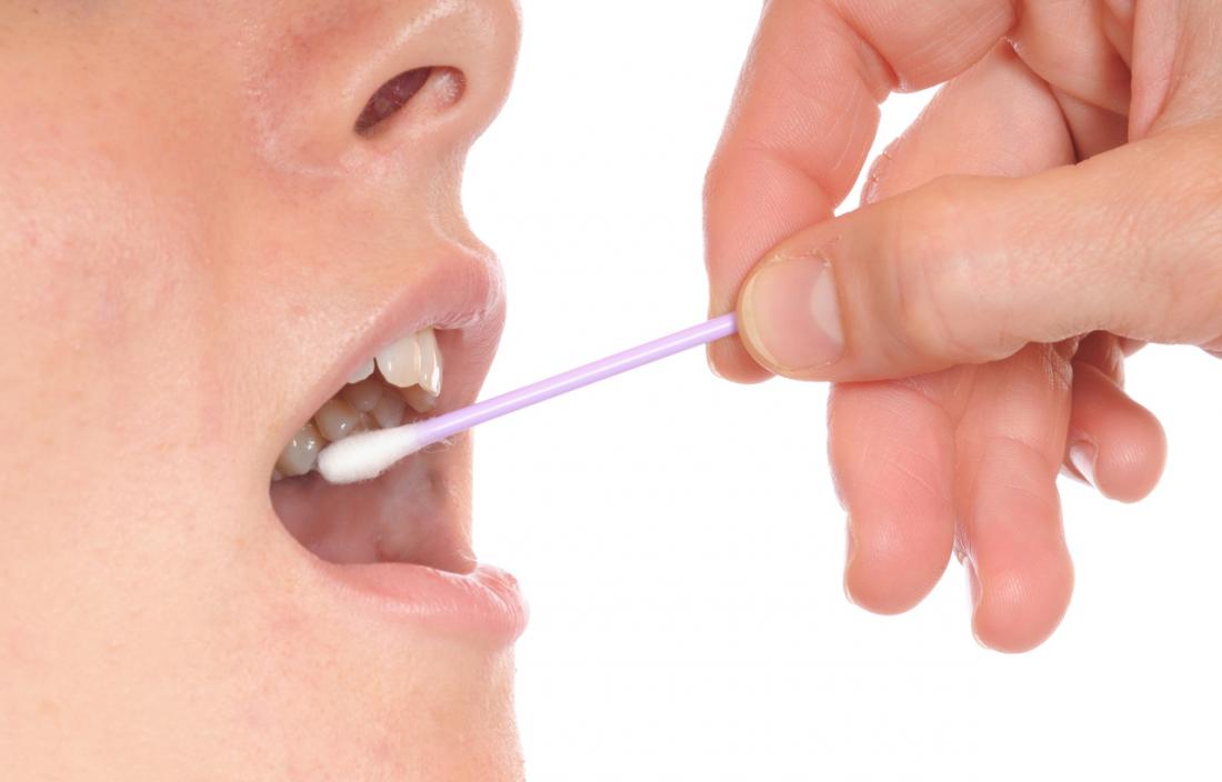 Mouth swab for burning mouth syndrome