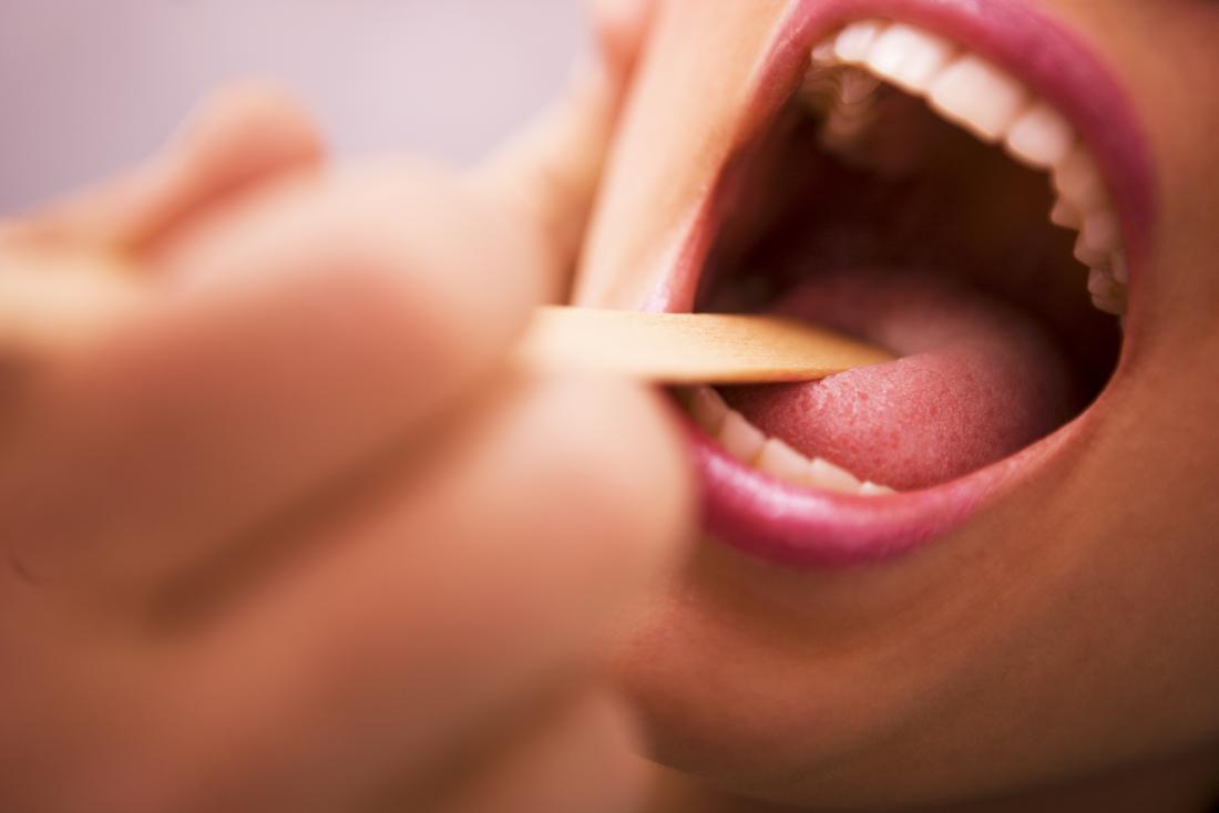 Patient having their tongue and throat inspected,