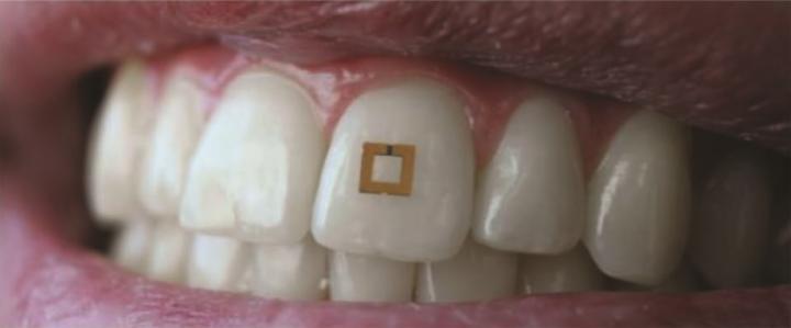 tooth mounted sensor